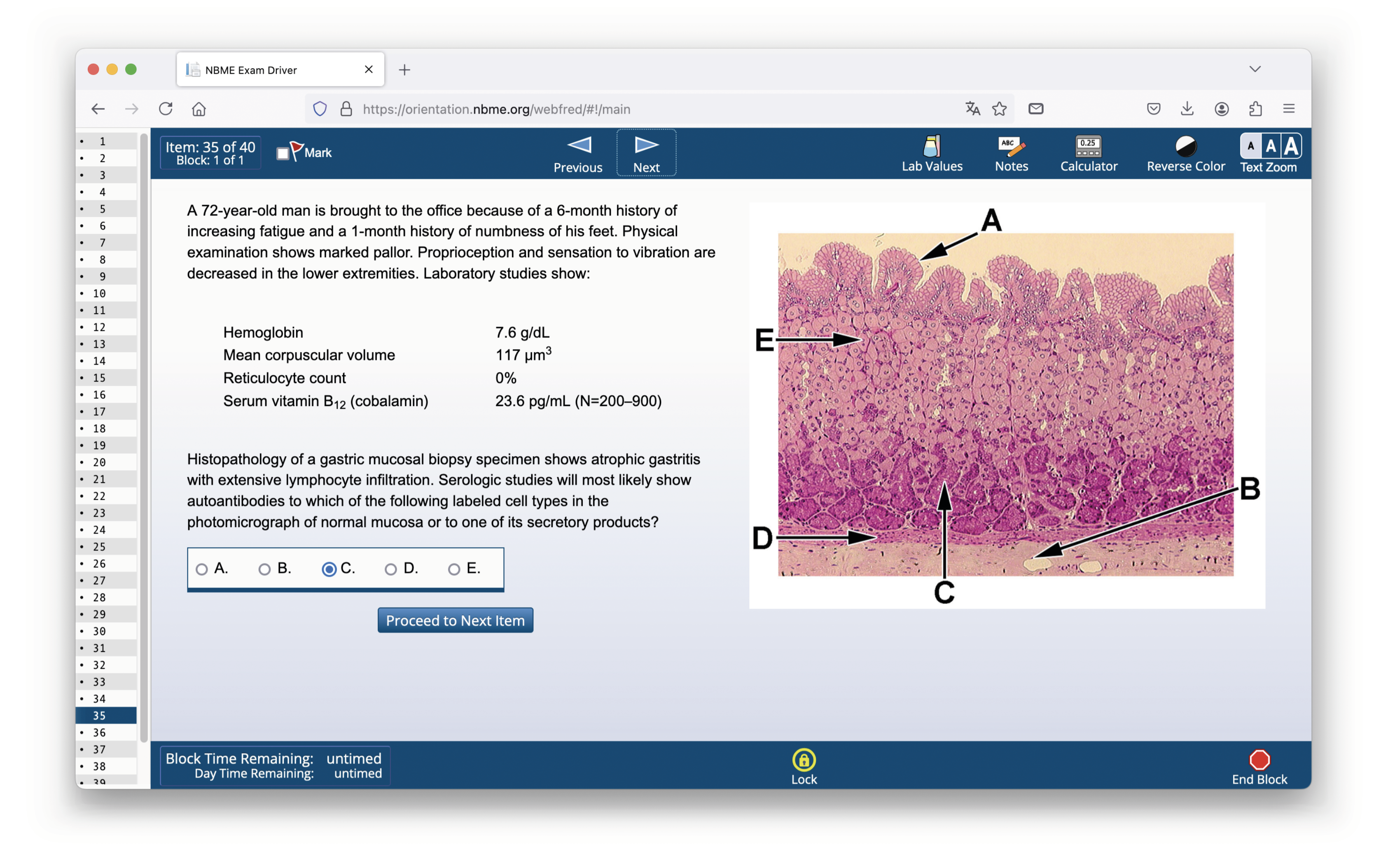 How GPT-4 Fails in Medical Tests - and Yet Still Convinces 